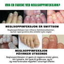 Neglepleie med ingefær