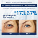 Krem for fjerning av poser under øynene - 💖Kjøp 1 få 1 gratis (2 stk)💖