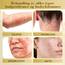 Konsentrert krem for reparasjon av biegift