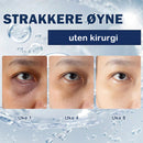 Krem for fjerning av poser under øynene - 💖Kjøp 1 få 1 gratis (2 stk)💖