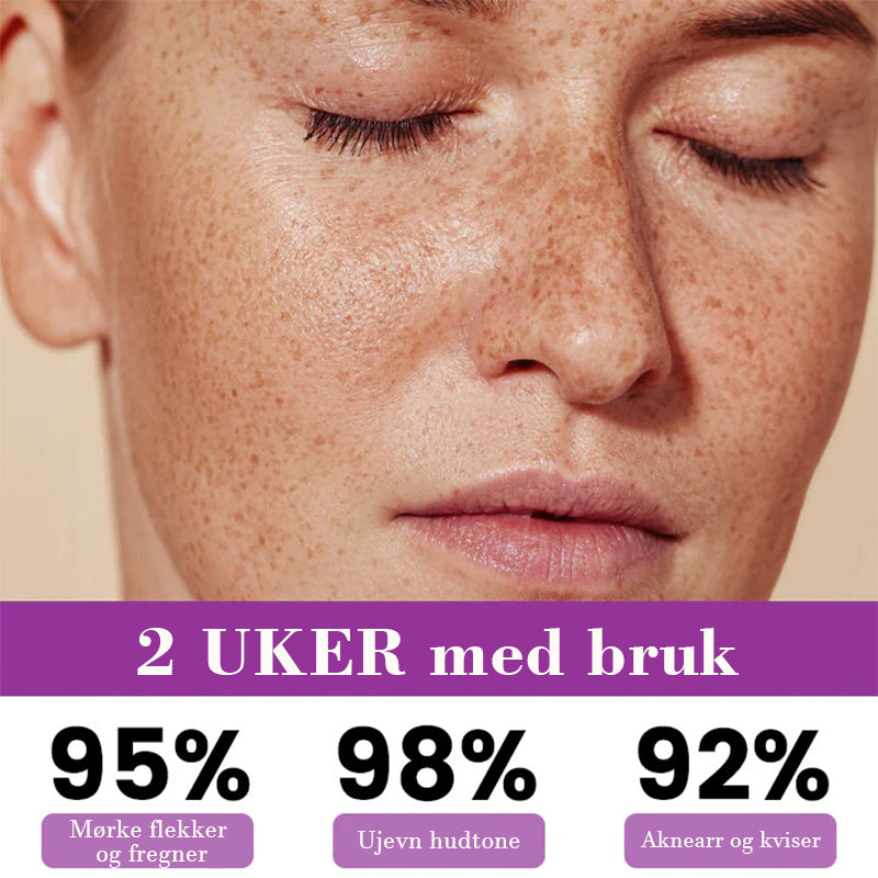 Avansert essens mot hyperpigmentering
