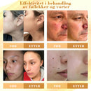 Konsentrert krem for reparasjon av biegift