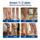 VeinEase mikronålbehandlingsplaster