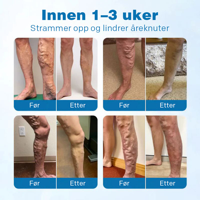 VeinGuard urtespray