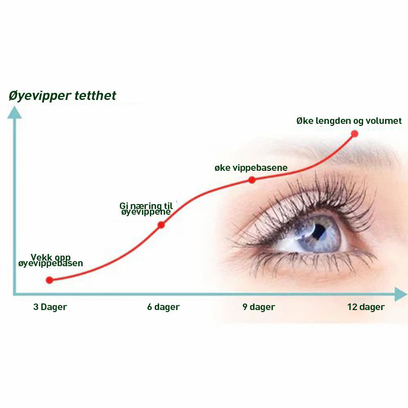 ØYENVIPPSERUM