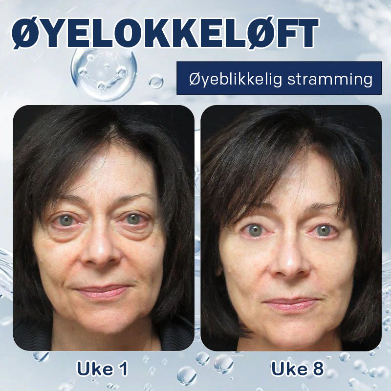 Krem for fjerning av poser under øynene - 💖Kjøp 1 få 1 gratis (2 stk)💖