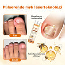 Avancerad nagelreparationsspray