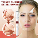 Essens for fjerning av flekker og føflekker - Kjøp 1 og få 1 gratis (2 stykk)