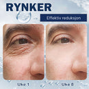 Krem for fjerning av poser under øynene - 💖Kjøp 1 få 1 gratis (2 stk)💖