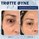 Krem for fjerning av poser under øynene - 💖Kjøp 1 få 1 gratis (2 stk)💖