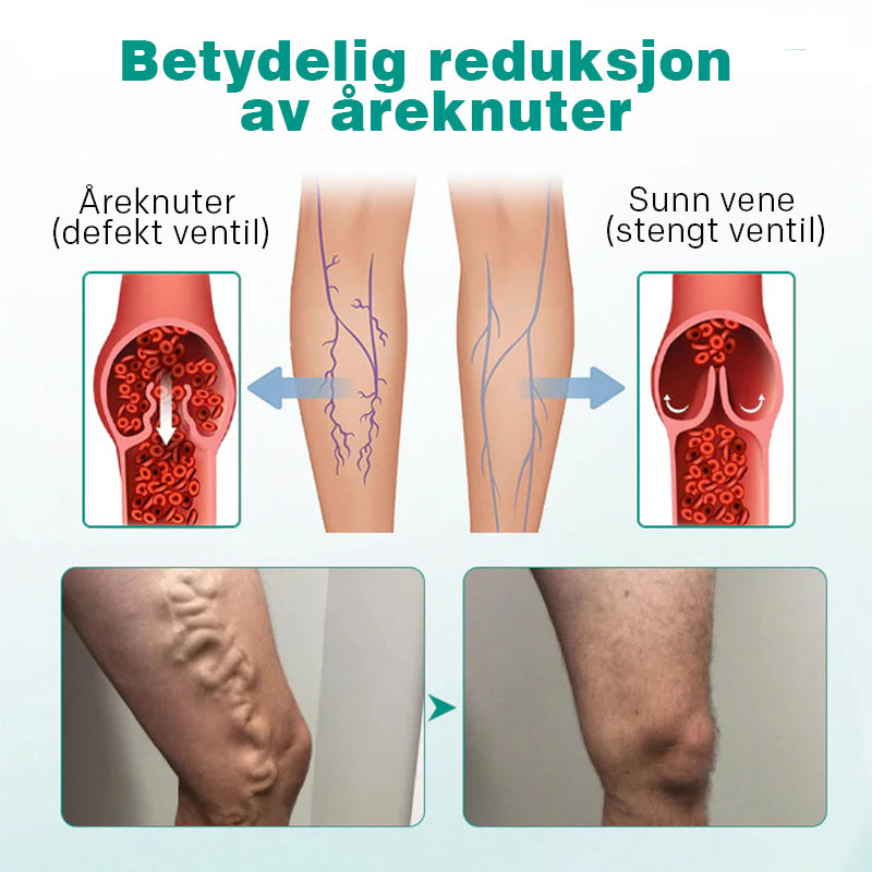 Åreknuter Plaster