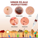 Essens for fjerning av flekker og føflekker - Kjøp 1 og få 1 gratis (2 stykk)