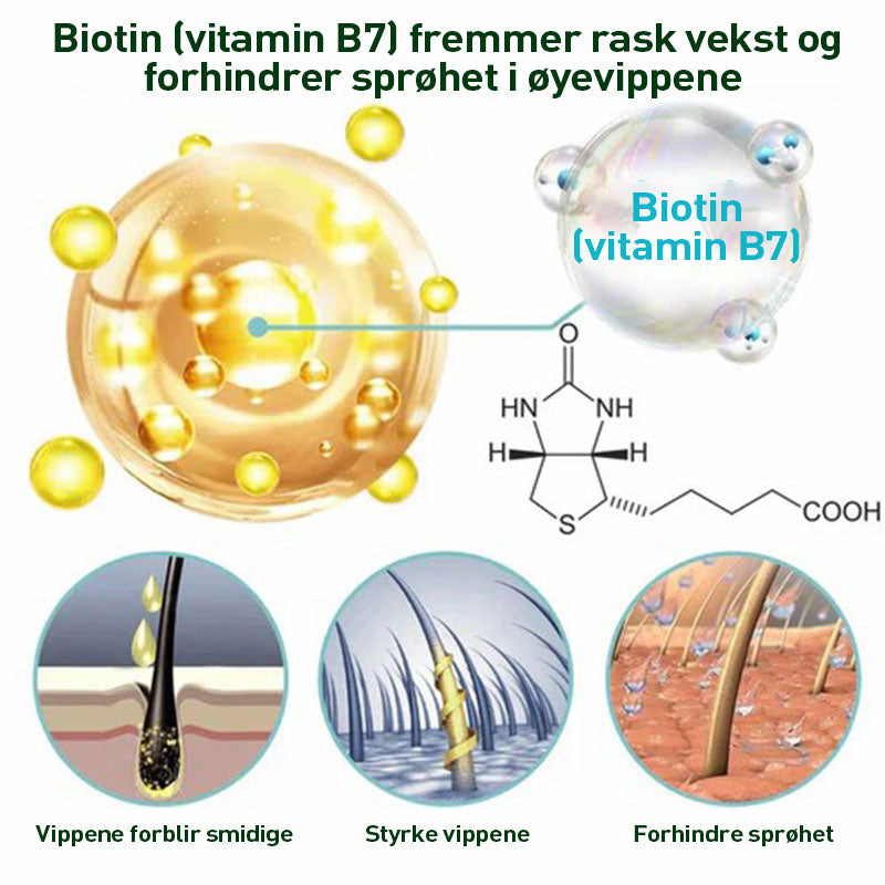 ØYENVIPPSERUM