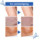 Krem for reparasjon av arr