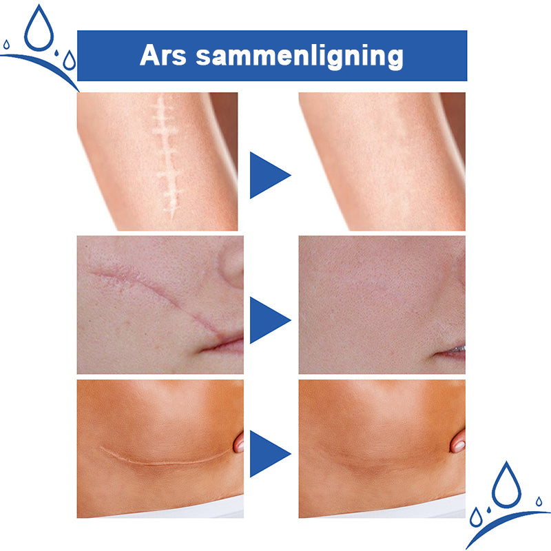 Krem for reparasjon av arr