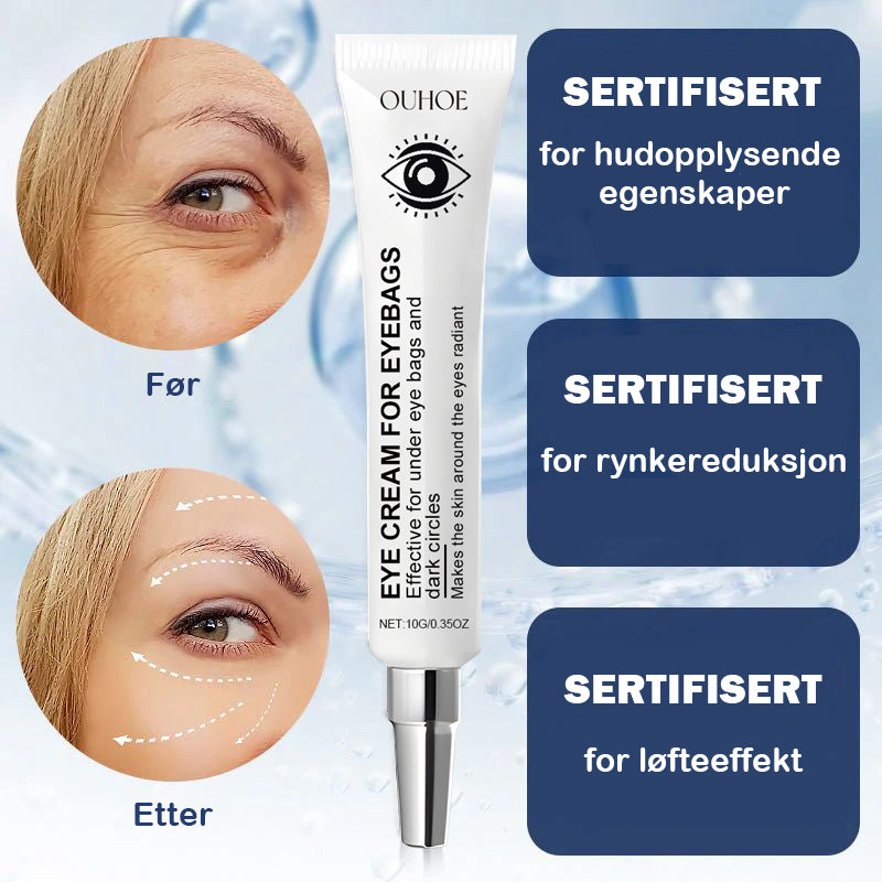 Krem for fjerning av poser under øynene - 💖Kjøp 1 få 1 gratis (2 stk)💖