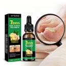 Neglepleie med ingefær