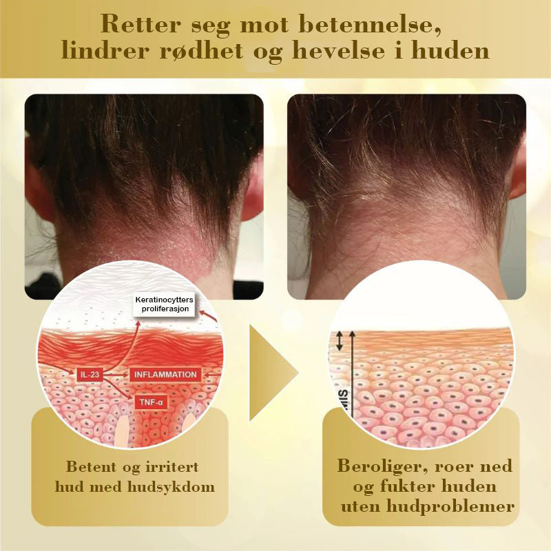 Konsentrert krem for reparasjon av biegift