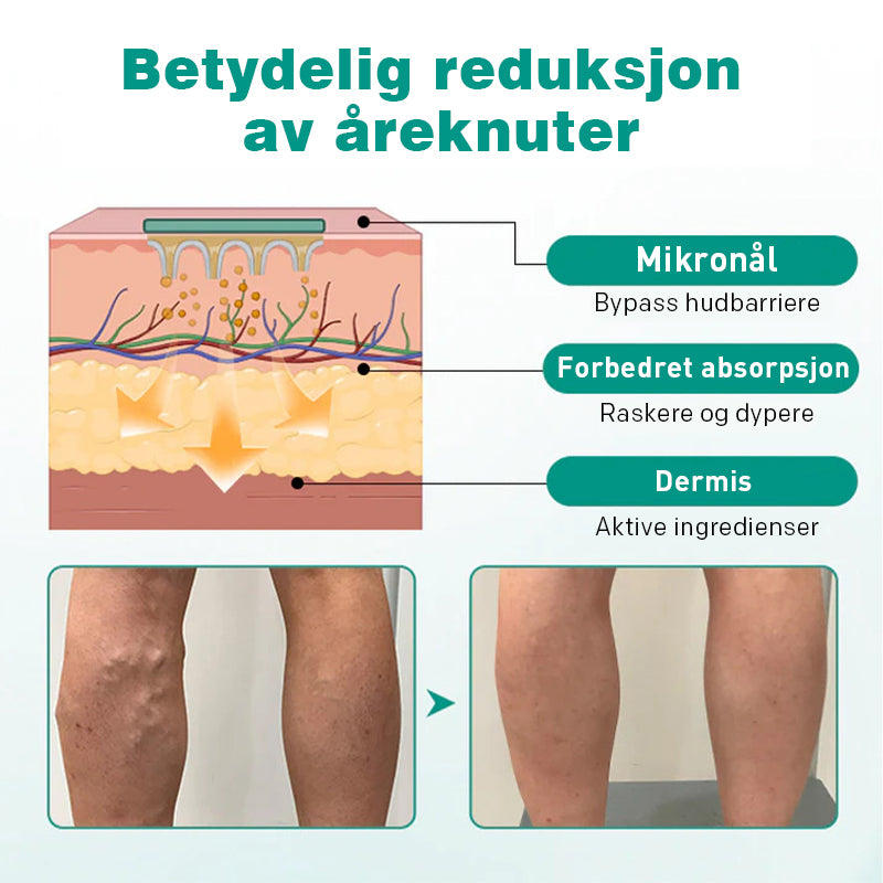Åreknuter Plaster