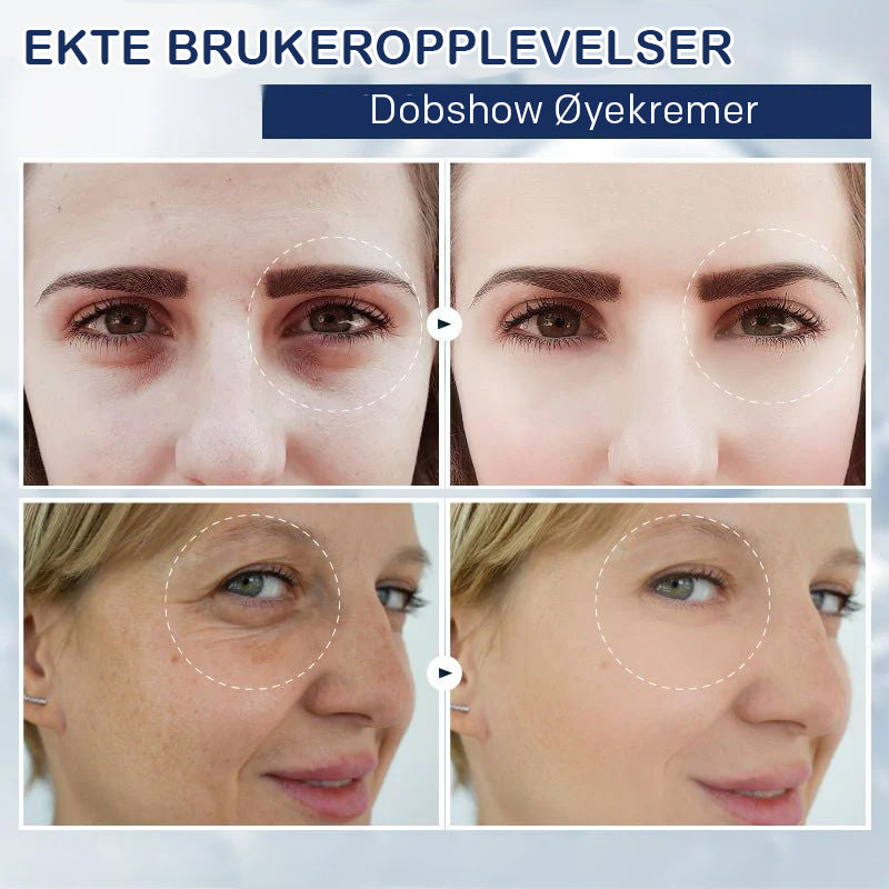 Krem for fjerning av poser under øynene - 💖Kjøp 1 få 1 gratis (2 stk)💖