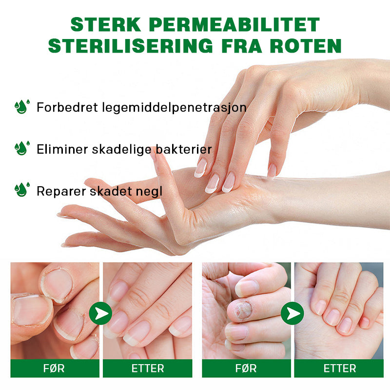 Neglepleie med ingefær