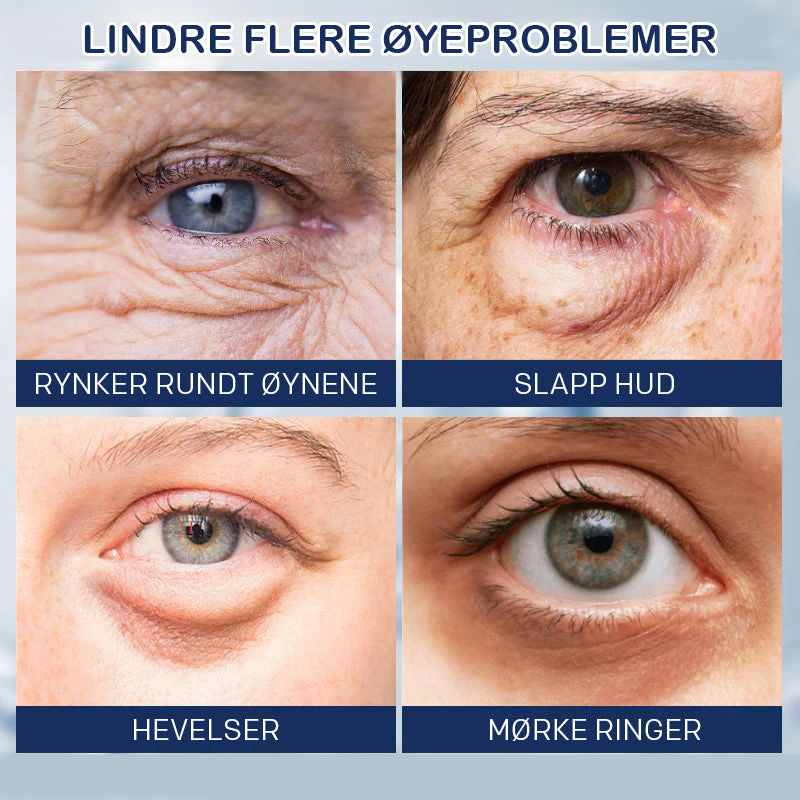 Krem for fjerning av poser under øynene - 💖Kjøp 1 få 1 gratis (2 stk)💖