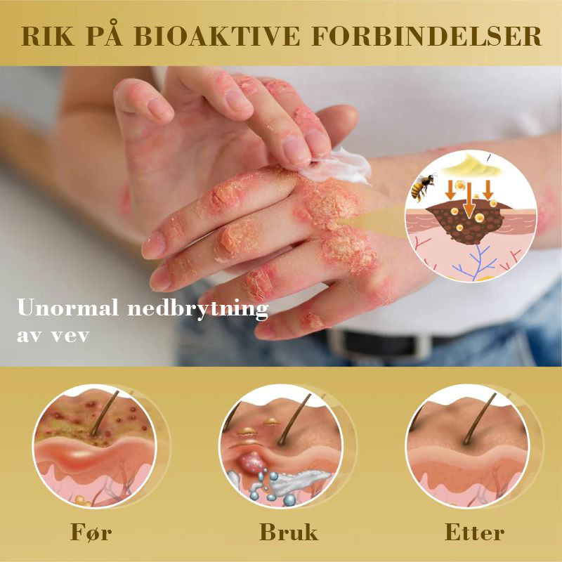 Konsentrert krem for reparasjon av biegift